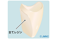 硬質レジンジャケット冠