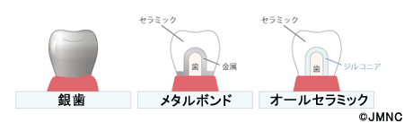 この治療って保険診療？自由診療？