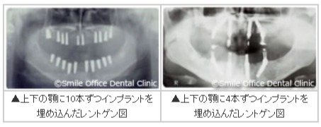 2. 低侵襲