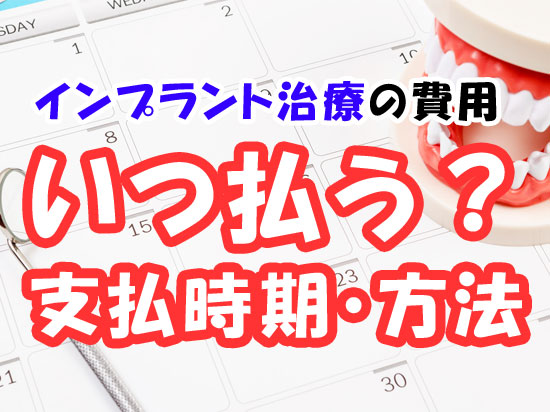 インプラント治療の費用を払うのはいつ？支払う時期や支払方法について