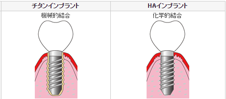 骨との結合