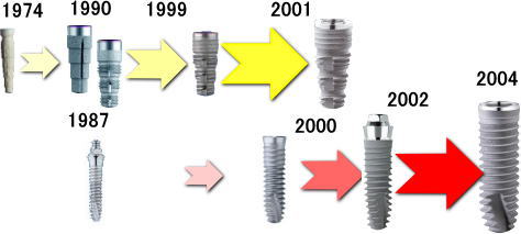 ザイブ インプラント- 誕生の歴史