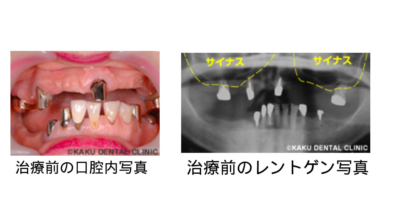 58歳 女性