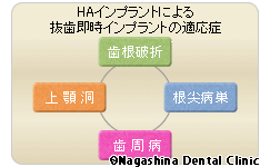 インプラントを埋め入れる部分に歯が残っている場合：抜歯対象歯