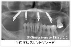 90分の手術時間