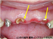 症例写真　治療前