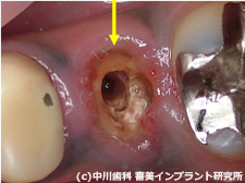 症例写真　治療前