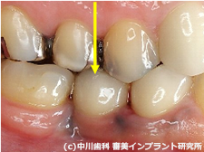 症例写真　治療後