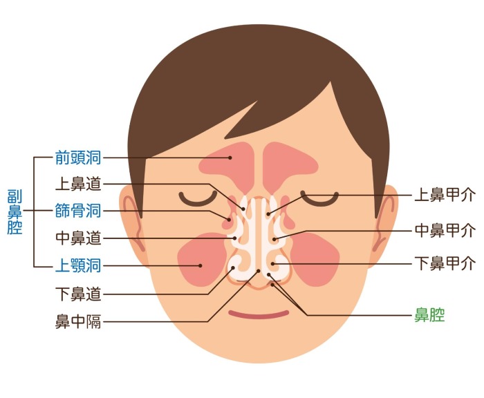 インプラント治療でまれに炎症を起こすことがあります。