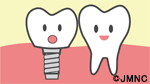 インプラント治療と保険について