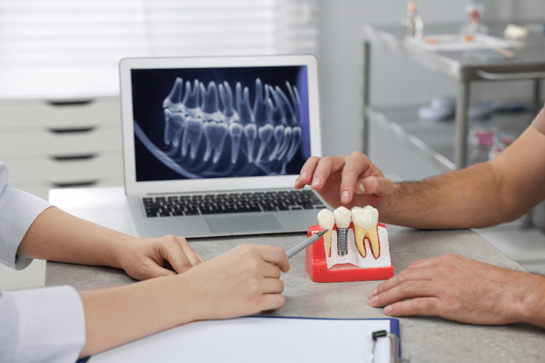 差し歯とインプラントの違いは？構造と治療期間について解説！