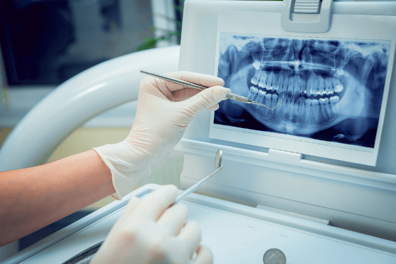 奥歯インプラントの相場は？奥歯の重要性と費用を解説！