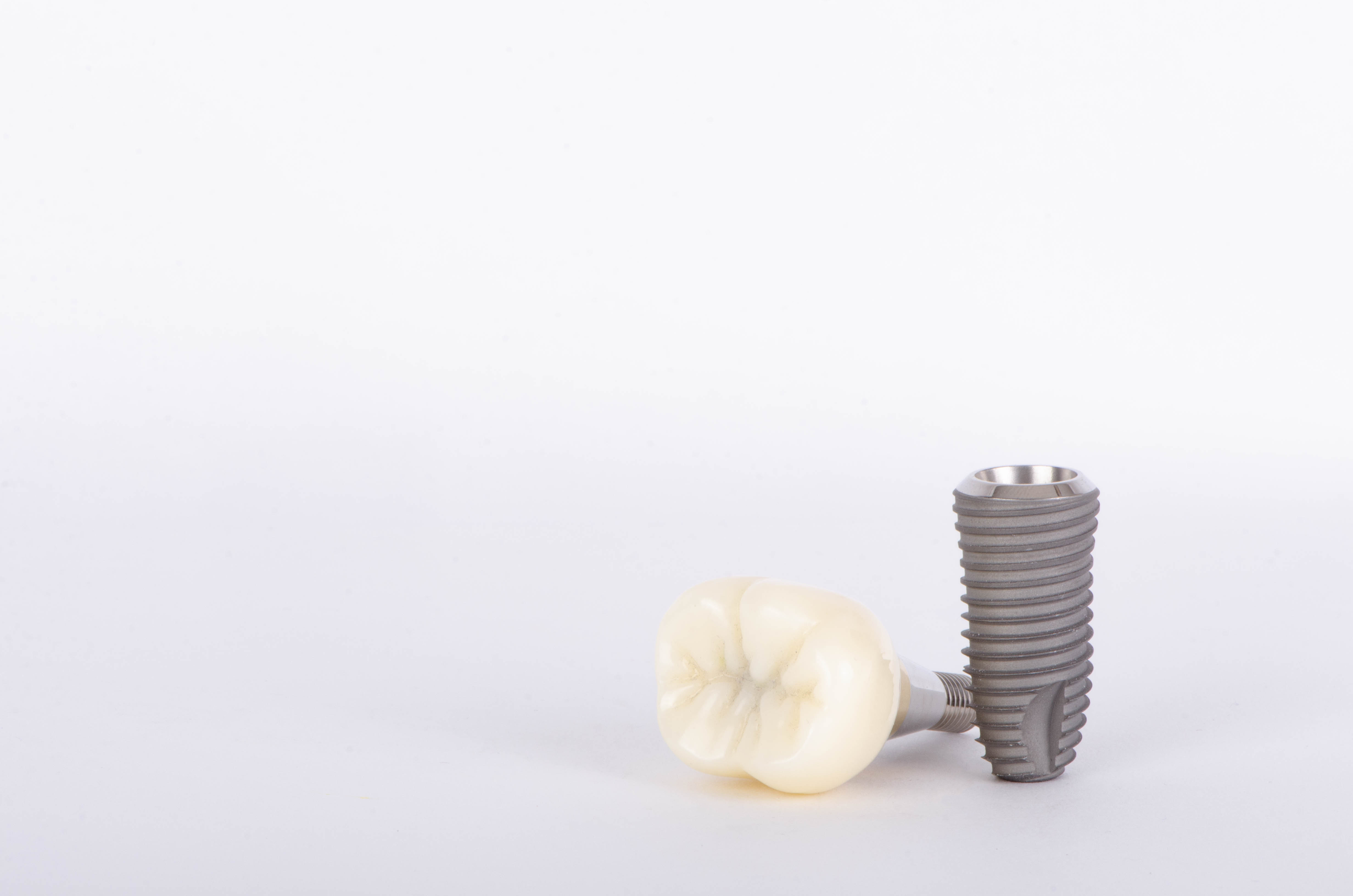 人工歯とインプラント