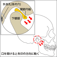 顎関節症