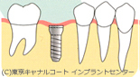 二回法