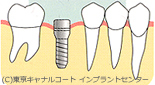 二回法