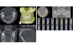 歯科用CT