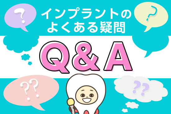 インプラントのよくある疑問Q&A