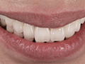 審美歯科治療とは何ですか?