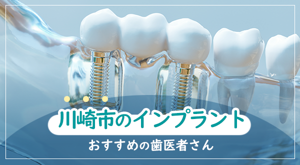 【2022年】インプラントならここ！川崎市でおすすめしたい注目の歯科医院