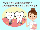 インプラントとは?