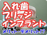 入れ歯、ブリッジとの違い