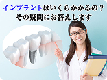 インプラントの費用